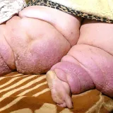 Foto: Ivica Jurgec/Medjimurski.hr