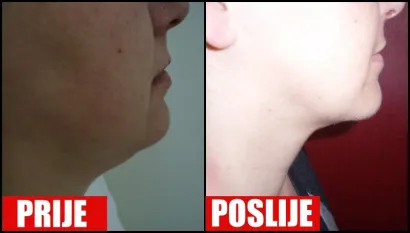 Foto: Poliklinika Maletić